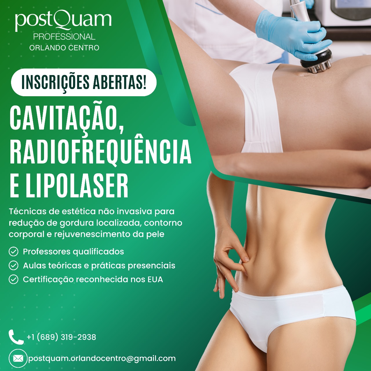 Cavitação, Radiofrequência e Lipolaser