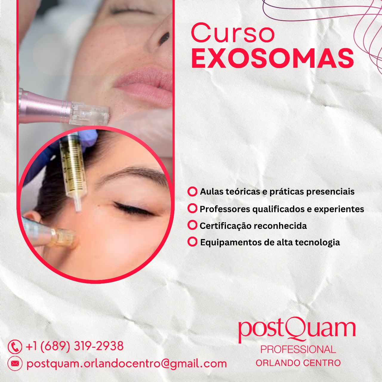 Exosomas